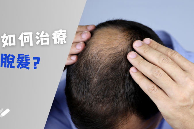 Moxibustion treats hair loss