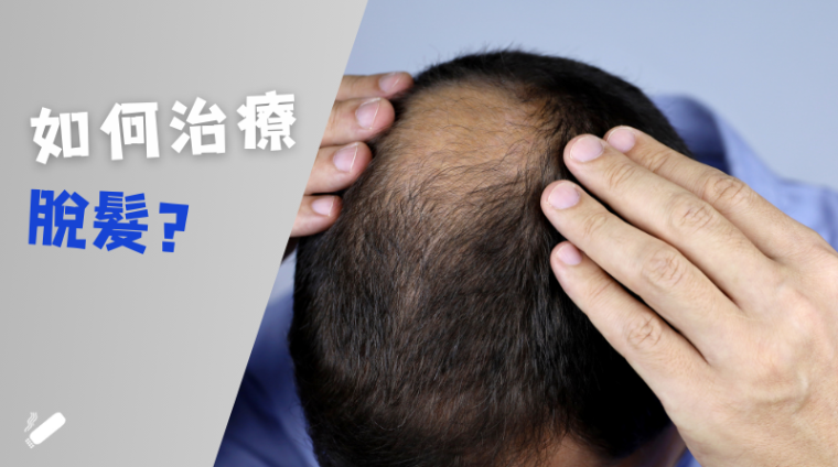 Moxibustion treats hair loss