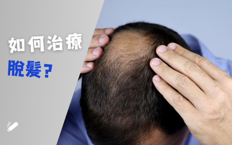 Moxibustion treats hair loss