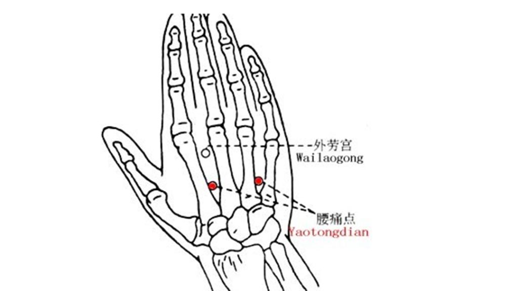 Four acupuncture points for low back pain2